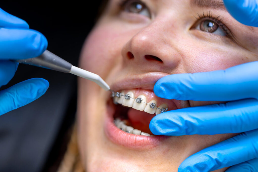 dental orthodontics in Dubai